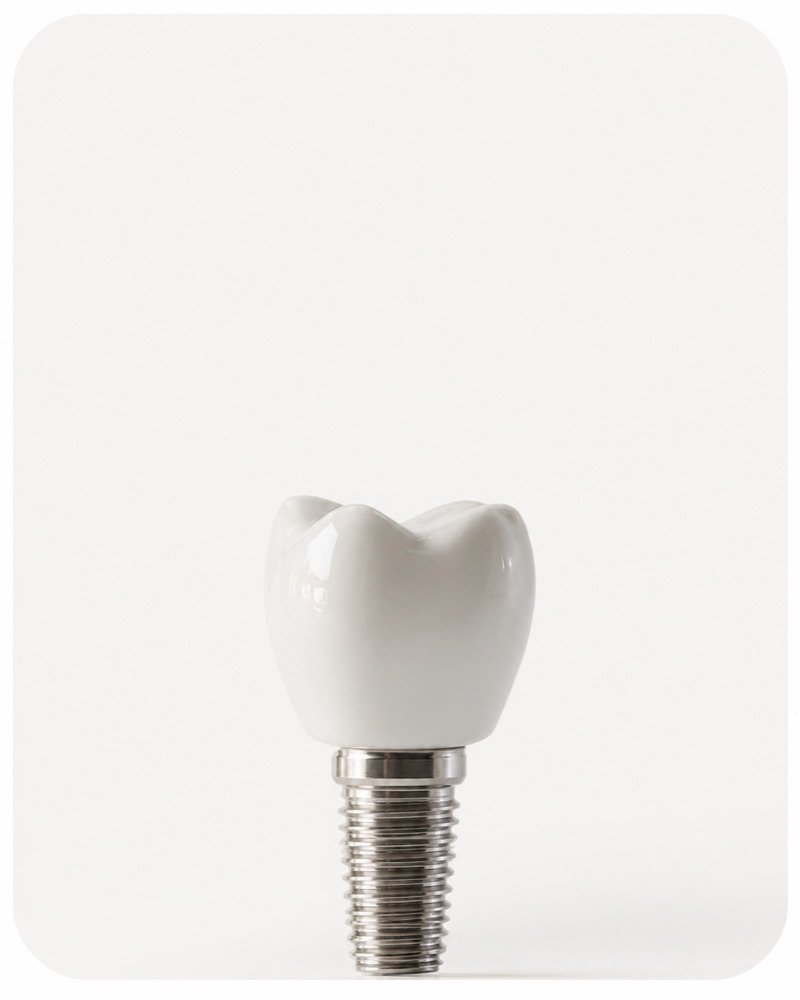 Dental implant and crown treatment at FLOSS Dental Studio