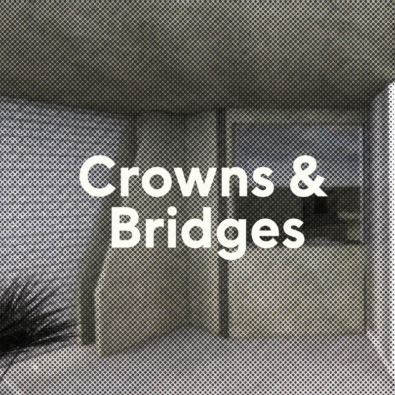 Crowns and bridges at FLOSS Dental Studio