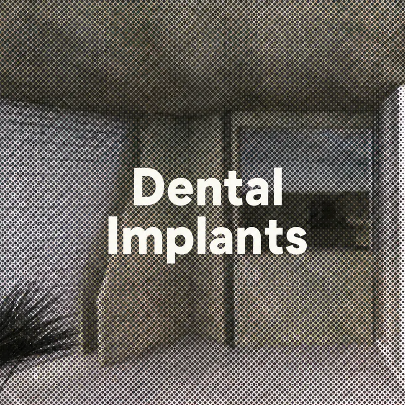 Dental implants at FLOSS Dental Studio