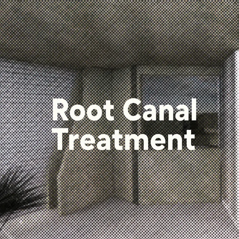 Root canal treatment at FLOSS Dental Studio